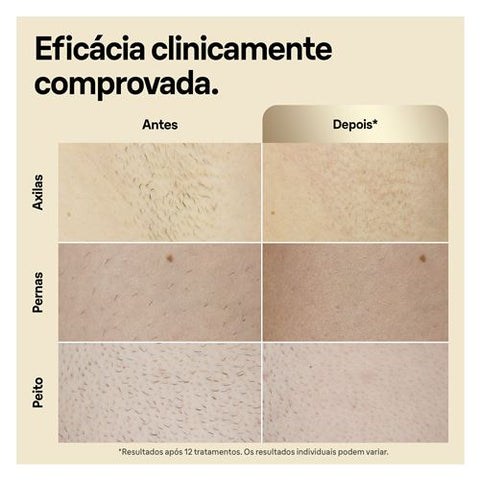 Depiladora Luz Pulsada IPL Braun Silk Expert S5 PL5140