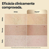 Luz Pulsada Braun Silk Expert Pro 5 PL5152 - Branco e Dourado